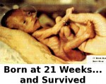 LifeSiteNews: 491 Babies Born Alive After Failed Abortions, Left to Die: Statistics Canada Confirms