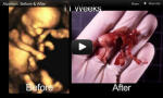 Culture Guard: Seeing Is Believing - Abortion is Murder